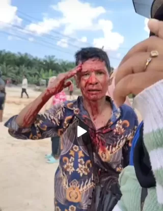 Peritiwa Berdarah di Duri 13! Warga Kerapatan Adat Sakai Terluka Diserang Karyawan PT SIS
