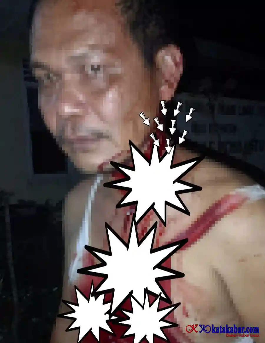 Hukum Dinilai Tumpul! Oknum Kades Diduga Bacok Warga Masih Bebas Polsek Dolok Didesak Bertindak